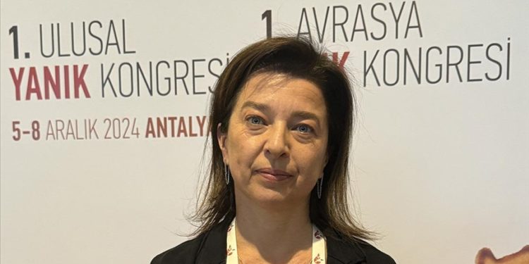 Türkiye yanık tedavilerinde bölgesinde referans ülke