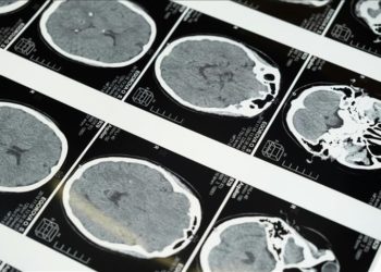 Yeni yapay zeka yazılımıyla inmenin geçirilme zamanı 2 kat daha doğru belirlenebiliyor